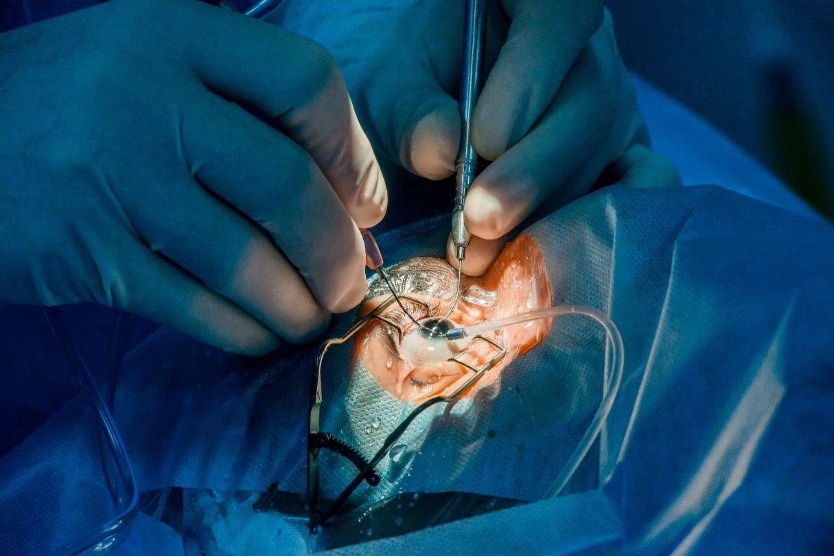 cataract